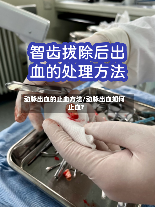 动脉出血的止血方法/动脉出血如何止血?