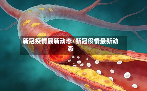 新冠疫情最新动态/新冠役情最新动态-第3张图片