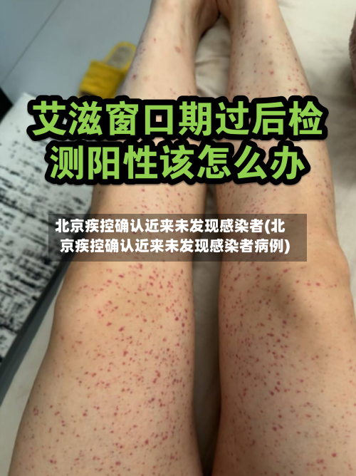 北京疾控确认近来未发现感染者(北京疾控确认近来未发现感染者病例)-第3张图片