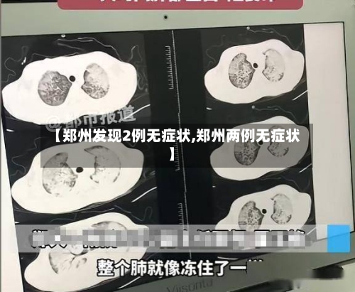 【郑州发现2例无症状,郑州两例无症状】