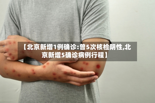 【北京新增1例确诊:曾5次核检阴性,北京新增5确诊病例行程】-第3张图片