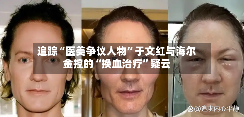 追踪“医美争议人物	”于文红与海尔金控的“换血治疗”疑云-第3张图片