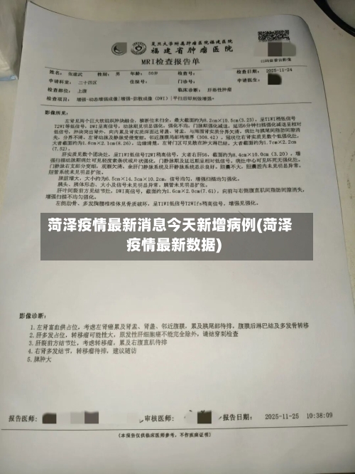 菏泽疫情最新消息今天新增病例(菏泽疫情最新数据)