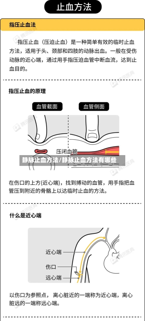 静脉止血方法/静脉止血方法有哪些-第2张图片