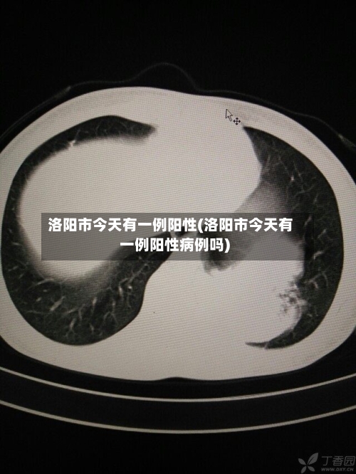 洛阳市今天有一例阳性(洛阳市今天有一例阳性病例吗)